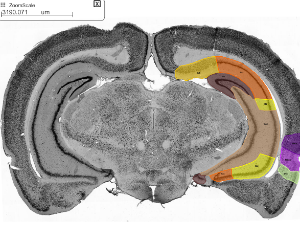 rat hippocampus anatomy ca1